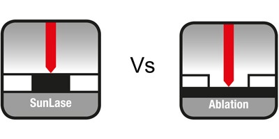 SunLase-vs-Ablation-Laser-Marking