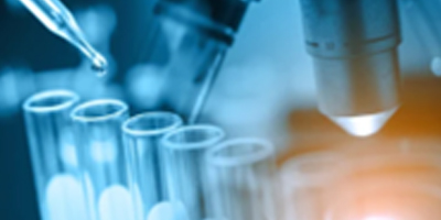 chemical-flasks-with-dropper-in-laboratory